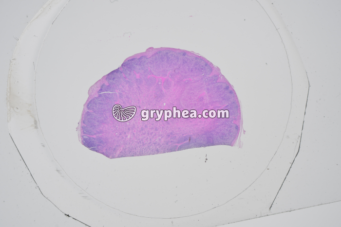 Ganglion lymphatique x1,5 - gryphea.org